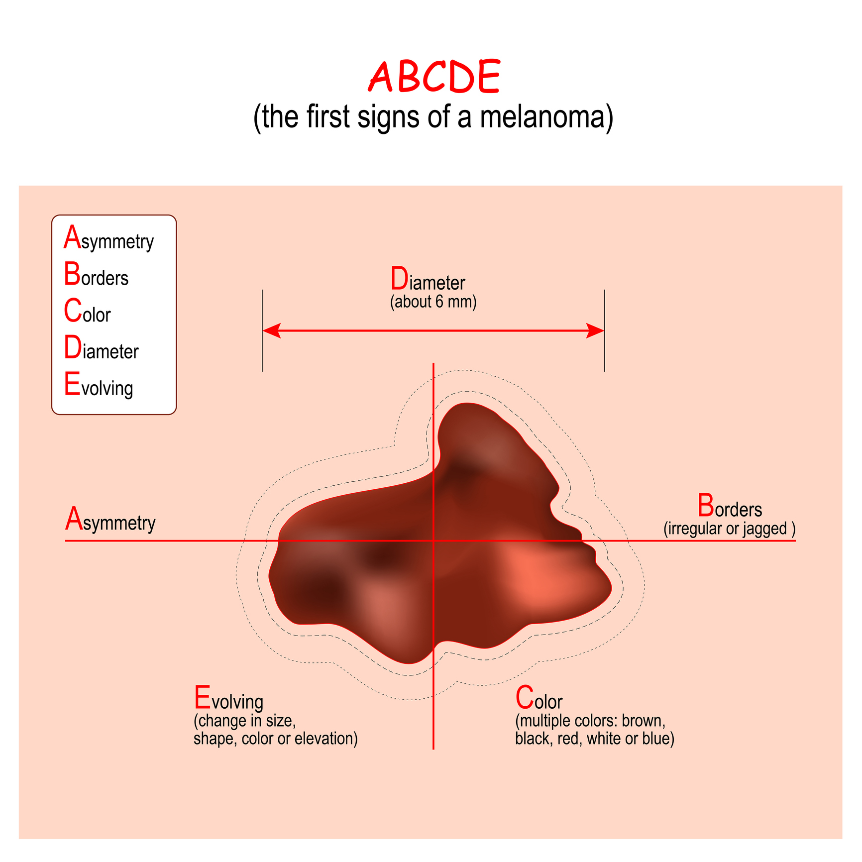 Αλγόριθμος ABCDE