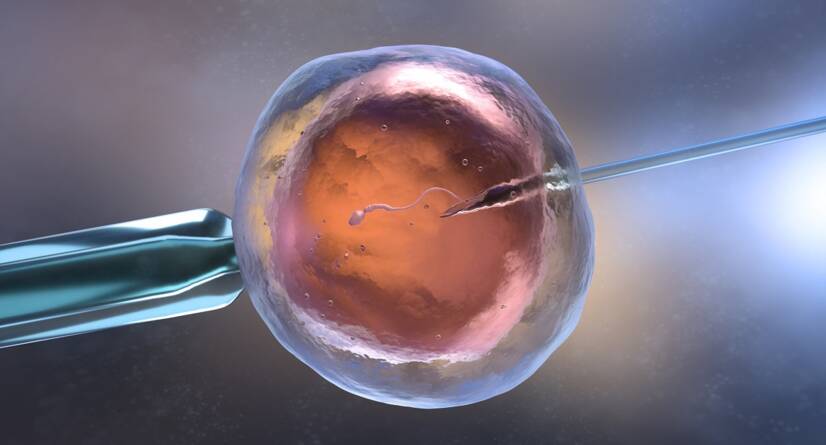 Εξωσωματική γονιμοποίηση IVF: Getty Images