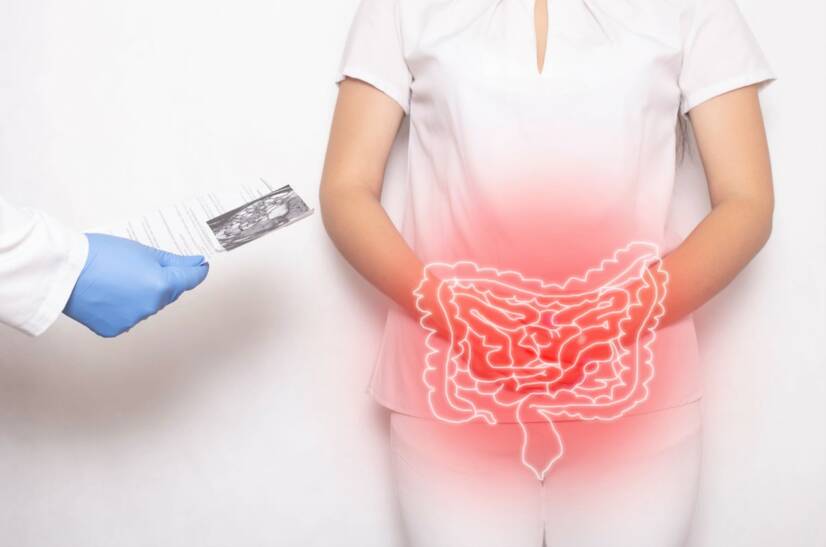 Νόσος του Crohn: τι είναι, γιατί εμφανίζεται και ποια είναι τα συμπτώματά της;